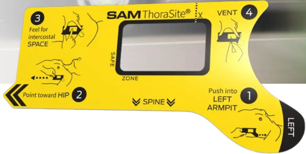 SAM MEDICAL TS200 5P EN Position Align Vent - fig 3