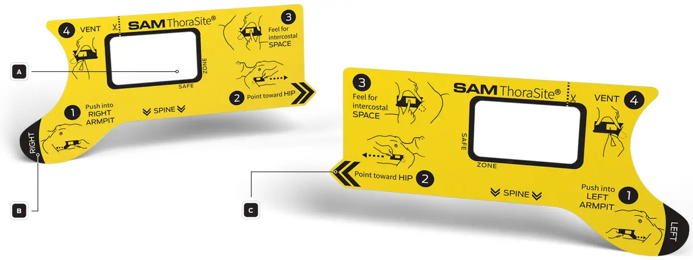 SAM MEDICAL TS200 5P EN Position Align Vent - fig