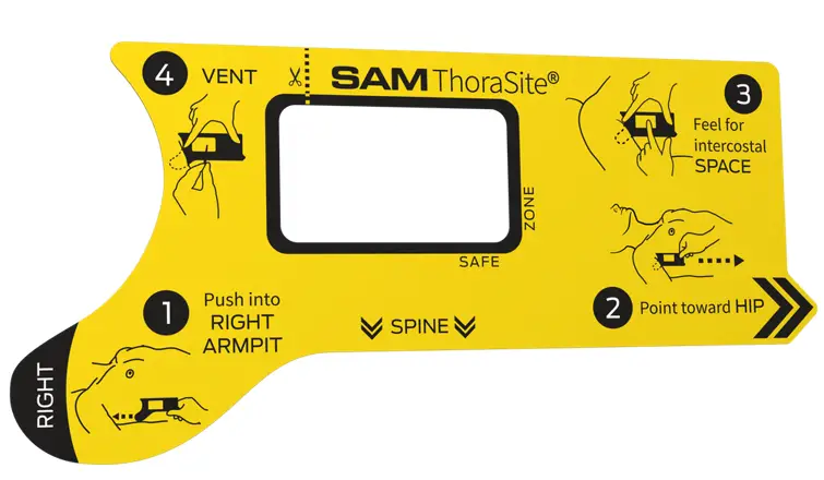 SAM MEDICAL TS200 5P EN Position Align Vent