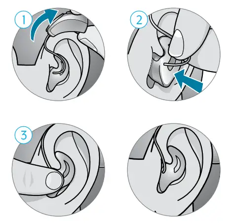 Starkey RIC 312 Micro Receiver-In - Insertion and Removal
