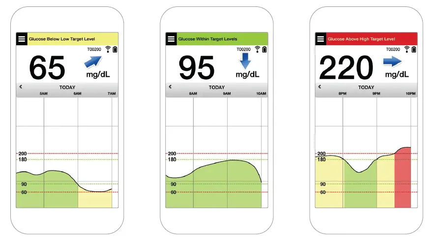 eversense-LBL-1603-01-001-Smart-Transmitter-Sensor-FIG- (1)