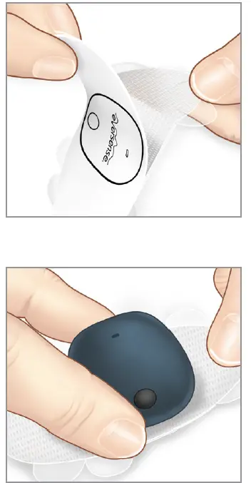 eversense-LBL-1603-01-001-Smart-Transmitter-Sensor-FIG- (19)