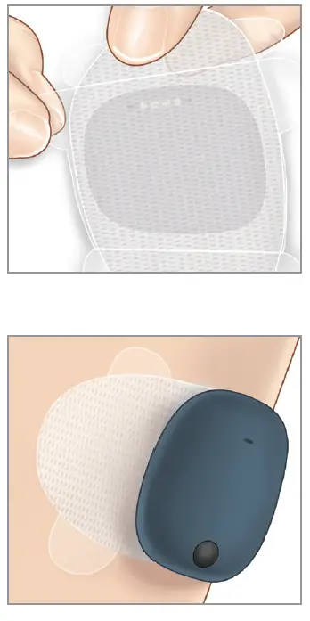 eversense-LBL-1603-01-001-Smart-Transmitter-Sensor-FIG- (20)