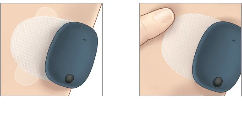 eversense-LBL-1603-01-001-Smart-Transmitter-Sensor-FIG- (22)