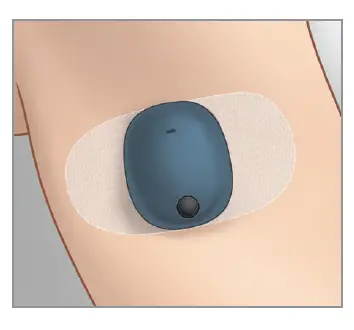 eversense-LBL-1603-01-001-Smart-Transmitter-Sensor-FIG- (4)