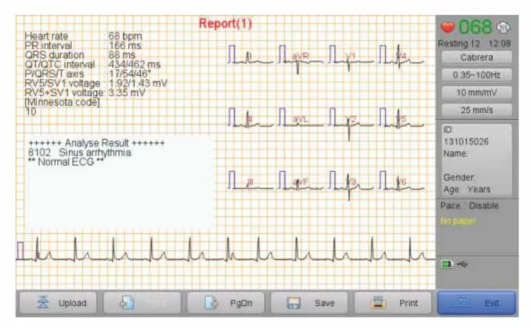 Analysis Report 1 before Printing