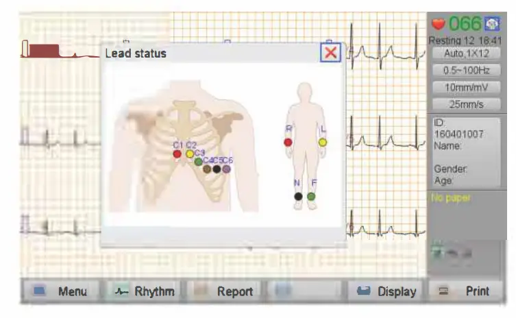 On-screen guide to check for loose leads