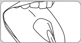 Waterpik Water Flosser WF-07 User Guide - Tongue Cleaner Tip