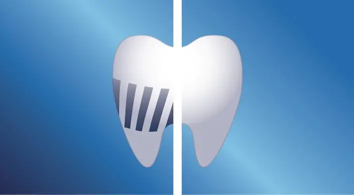 Philips Sonicare Standard Sonic Toothbrush Better check-ups guaranteed