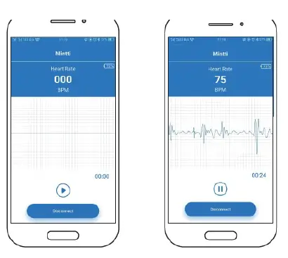 minttihealth Smartho-D2 Electronic Stethoscope fig -7