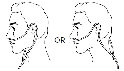 Precision-Medical-PM4100-Series-EasyPulse-POC-Oxygen-Concentrator-7