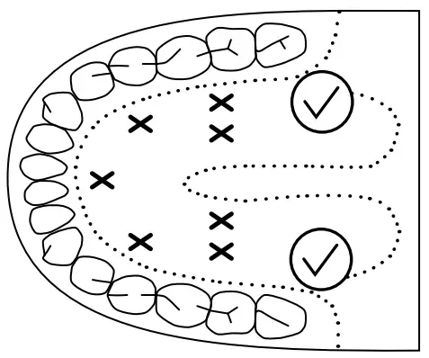 truelife Care T3 Contact Thermometer - INDIVIDUAL MODES
