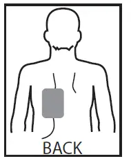 ZOLL OneStep Complete and CPR Resuscitation Electrodes fig 5