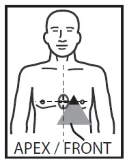 ZOLL OneStep Complete and CPR Resuscitation Electrodes fig 6