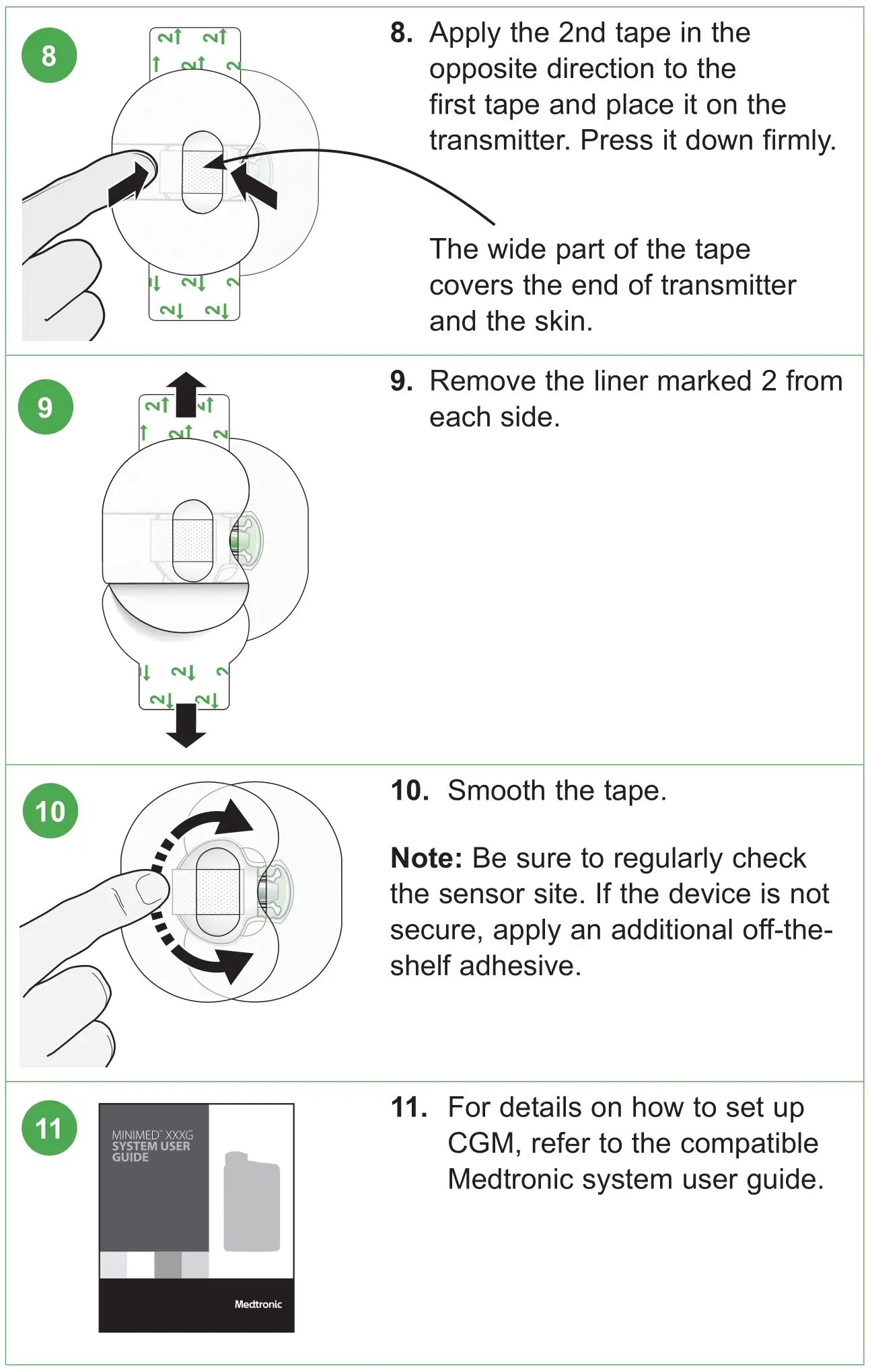 medtronic MMT7020A Guardian Sensor 3 Glucose Sensor - Applying Oval Tape 3
