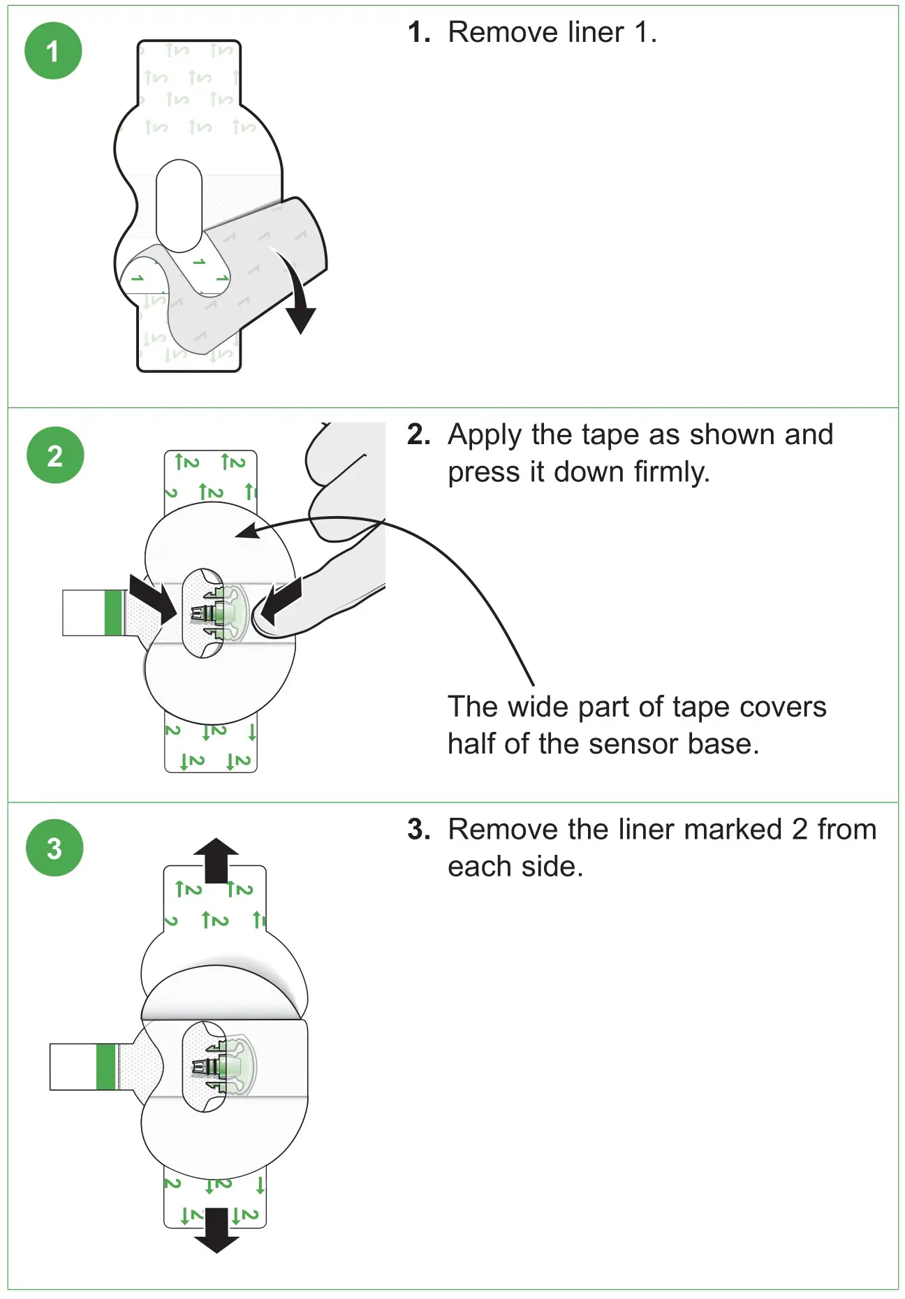 medtronic MMT7020A Guardian Sensor 3 Glucose Sensor - Applying Oval Tape