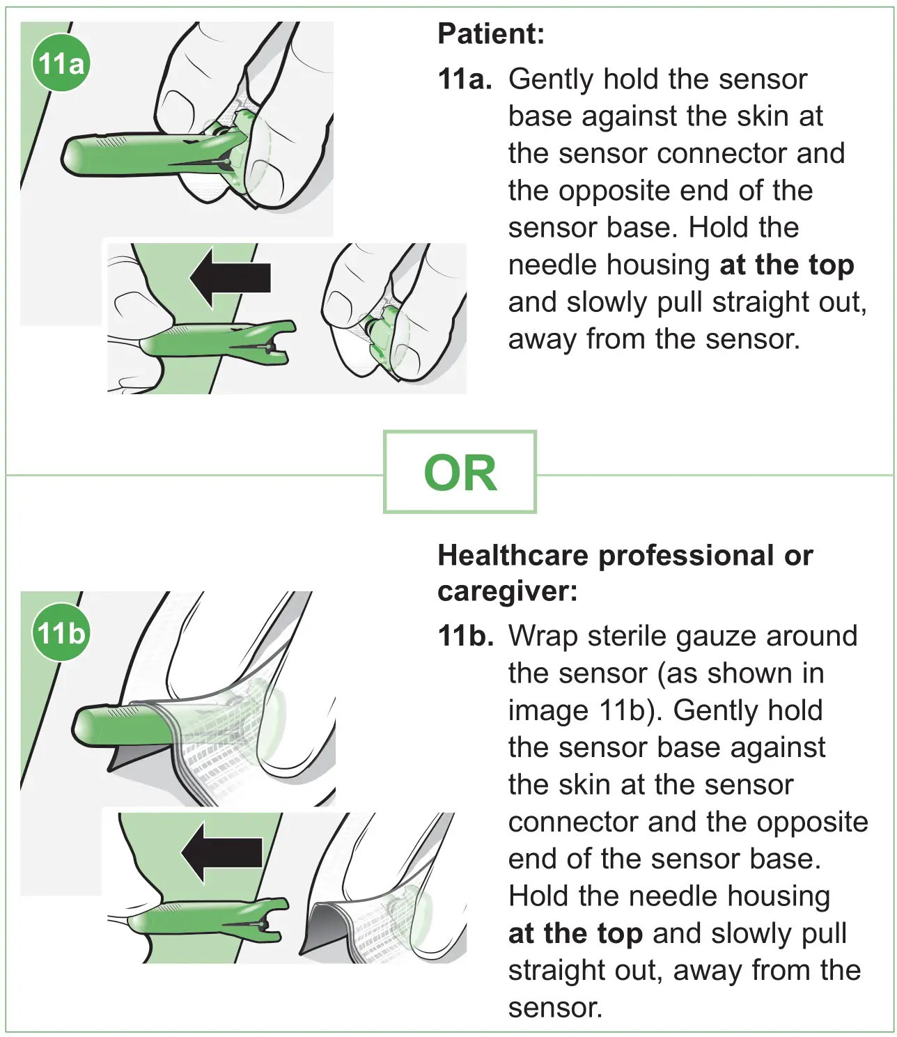 medtronic MMT7020A Guardian Sensor 3 Glucose Sensor - Inserting the sensor 5