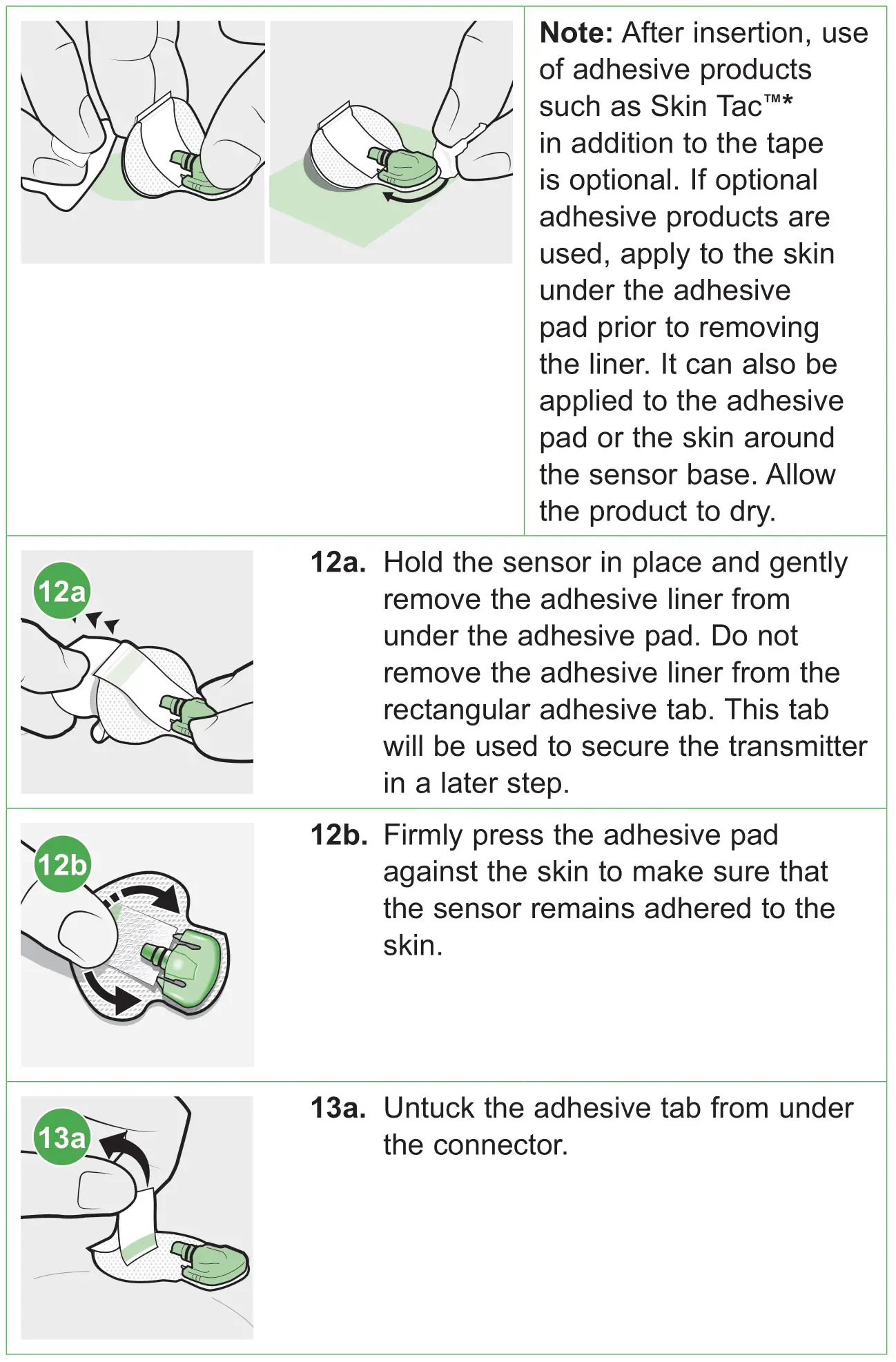 medtronic MMT7020A Guardian Sensor 3 Glucose Sensor - Inserting the sensor 6