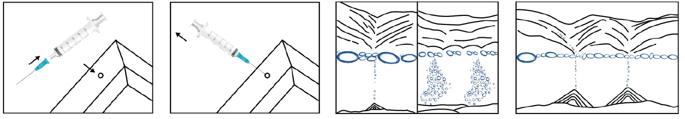 wall-mount-sandelier-fig-2