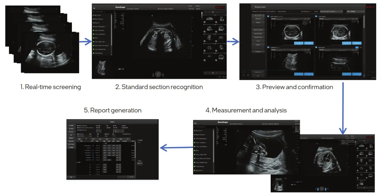 intel oneAPI Base Toolkit Helps SonoScape Optimize the Performance of its S-Fetus 4.0 Obstetric Screening Assistant - 2