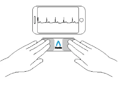 AliveCor KardiaMobile 6L Wireless ECG Recorder System-3