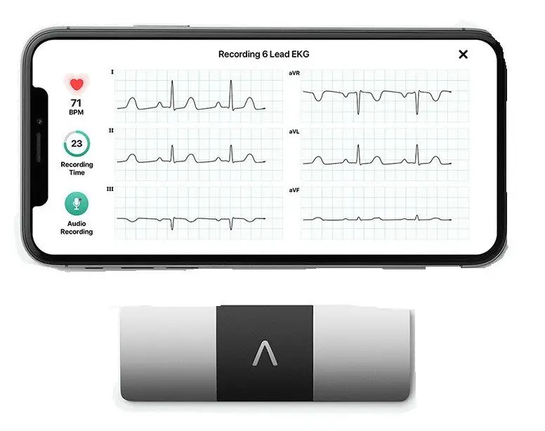 AliveCor KardiaMobile 6L Wireless ECG Recorder System-product