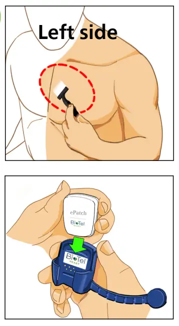 PHILIPS ePatch Extended Wear Holter-1