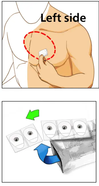 PHILIPS ePatch Extended Wear Holter-2