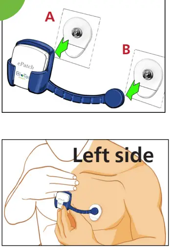 PHILIPS ePatch Extended Wear Holter-3