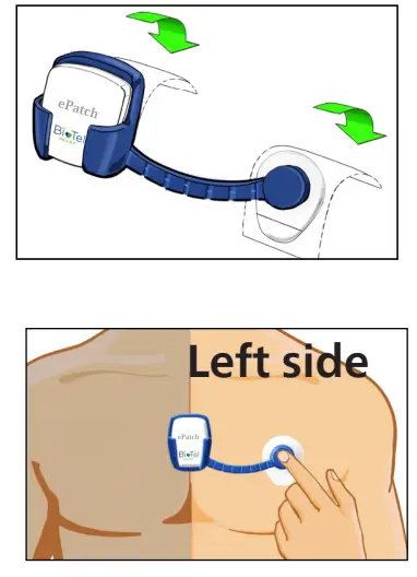 PHILIPS ePatch Extended Wear Holter-4