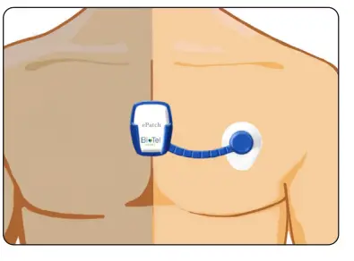 PHILIPS ePatch Extended Wear Holter-6