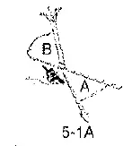 Poulan-PLN1514-Electric-Chain-Saw-19