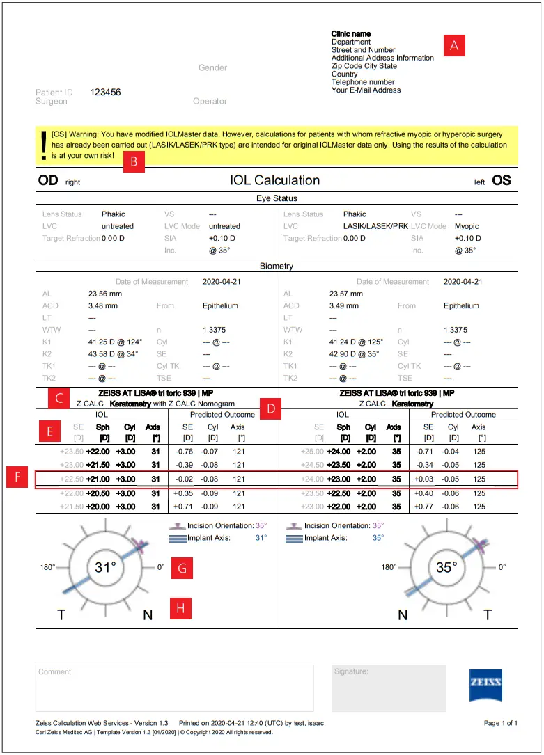 ZEISS Z CALC 2 2 Toric and Non Toric IOL Calculation and Ordering - PDF printouts 2