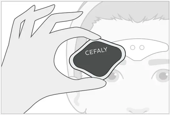 CEFALY ACUTE Dual Enhanced Migraine Treatment and Preventive Kit - Electrode Care 5