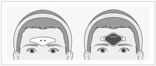 CEFALY ACUTE Dual Enhanced Migraine Treatment and Preventive Kit - First Things First 3