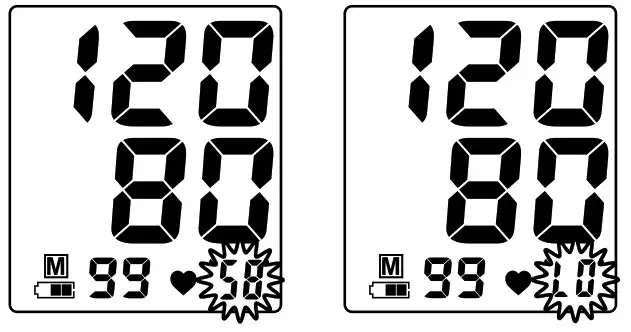 SureLife 4332595483 Arm Blood Pressure Monitor- Normal Heartbeat