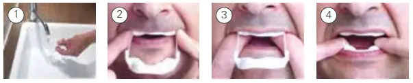 ResMed Mandibular Repositioning Device-4