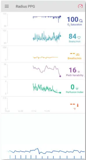 Masimo SafetyNet APP - figure 10