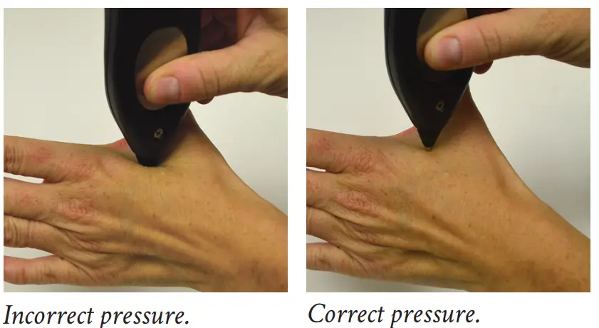 Dolphin Neurostim AML DNSKRX OTC OTC Simulation - fig 8