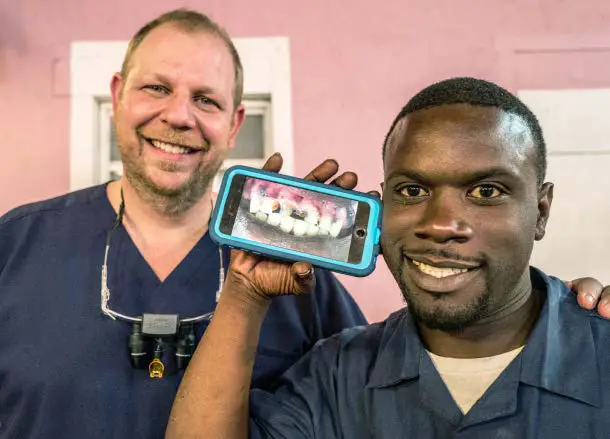 glo 558113 Take Home Wireless Teeth Whitening Device Kit - figure 15