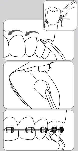 Waterpik Cordless Advanced Water Flosser For Teeth-9