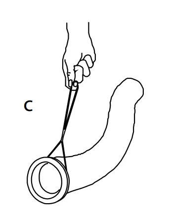 Installation Overview