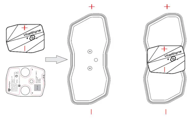 VitalSigns VSH101 Lead Holter- installation