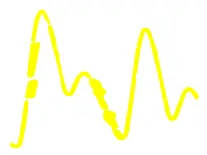Determining Pulse Signal Quality