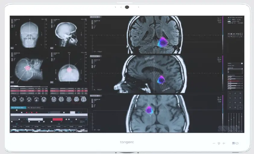 tangent M24T Medix 24 Inch Medical Computer