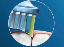 Philips-Sonicare-HX9073-65-Toothbrush-Fig-1