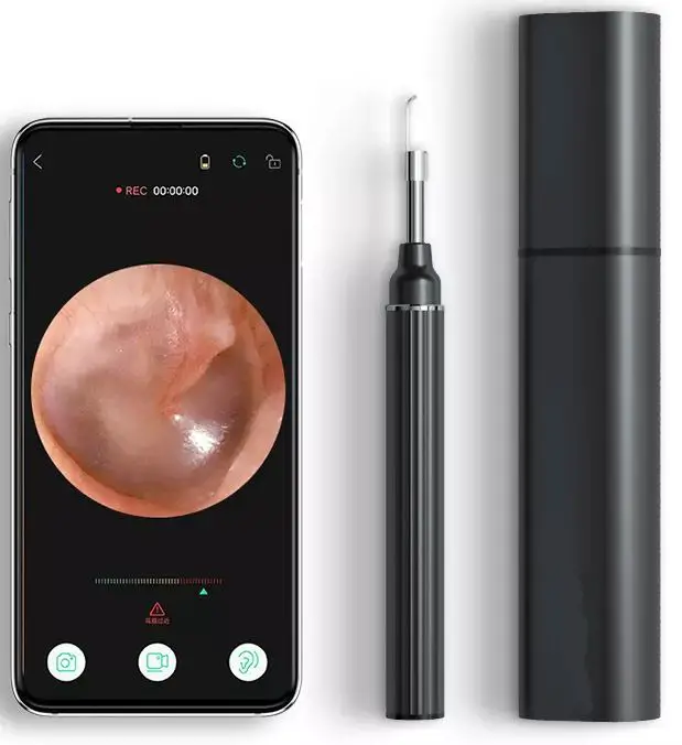 Shenzhen-Ximalong-Hi-Tech-E1-Intelligent-Visual-Ear-Pick-PRODUCT