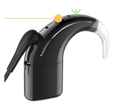 Cochlear Nucleus 8 Sound Processor - fig 7