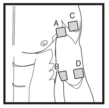 beurer EM 49 Digital Tens Unit fig 11