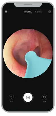 XLIFE Q3 Smart Visual Ear Clean Rod - fig 4